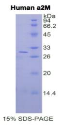 SDS-PAGE (A2M-5731H).jpg